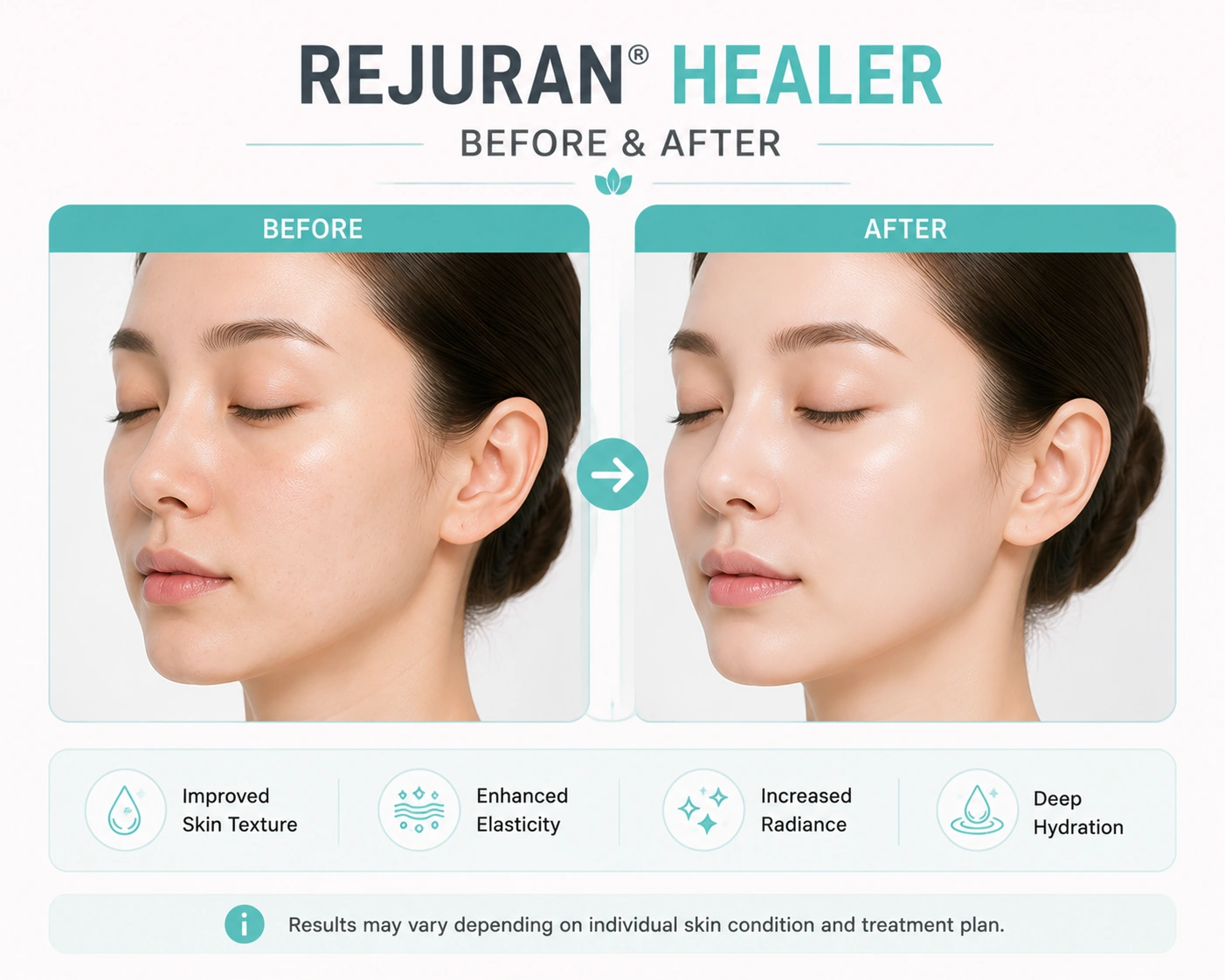 Rejuran Healer Before and After: Realistic Results Timeline by Week 1 Rejuran Healer Before and After in Malaysia