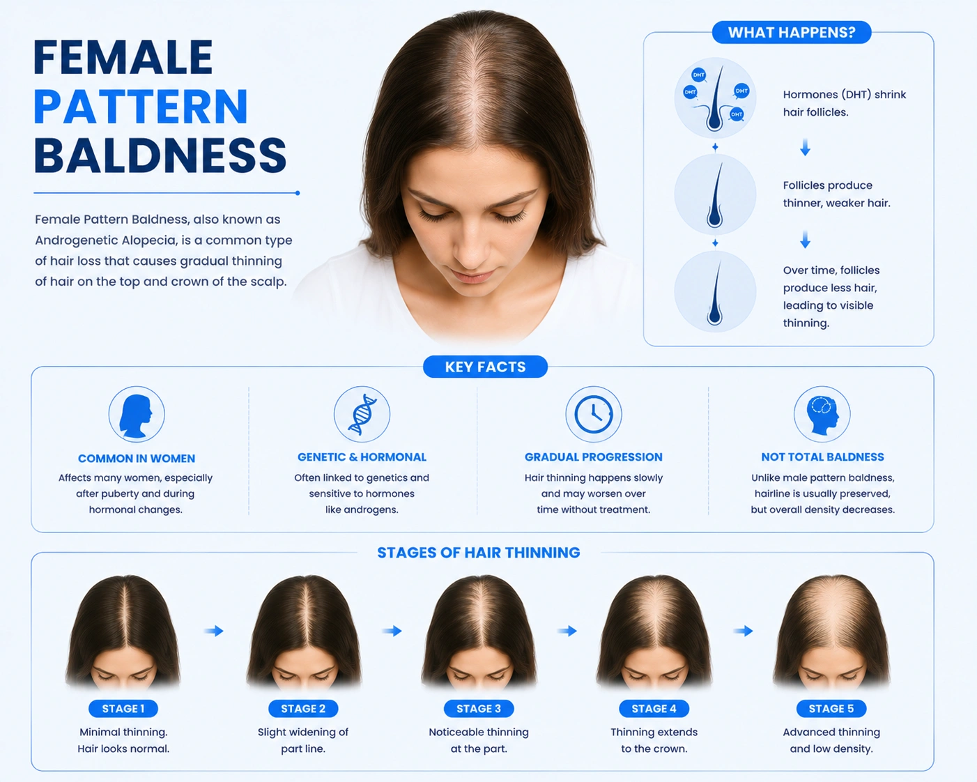 female pattern baldness (androgenetic alopecia)