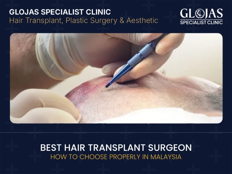 how to choose hair transplant surgeon