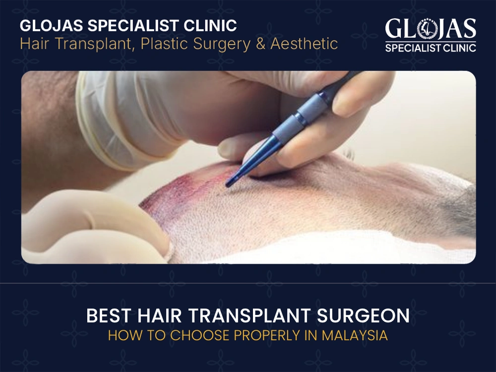 how to choose hair transplant surgeon
