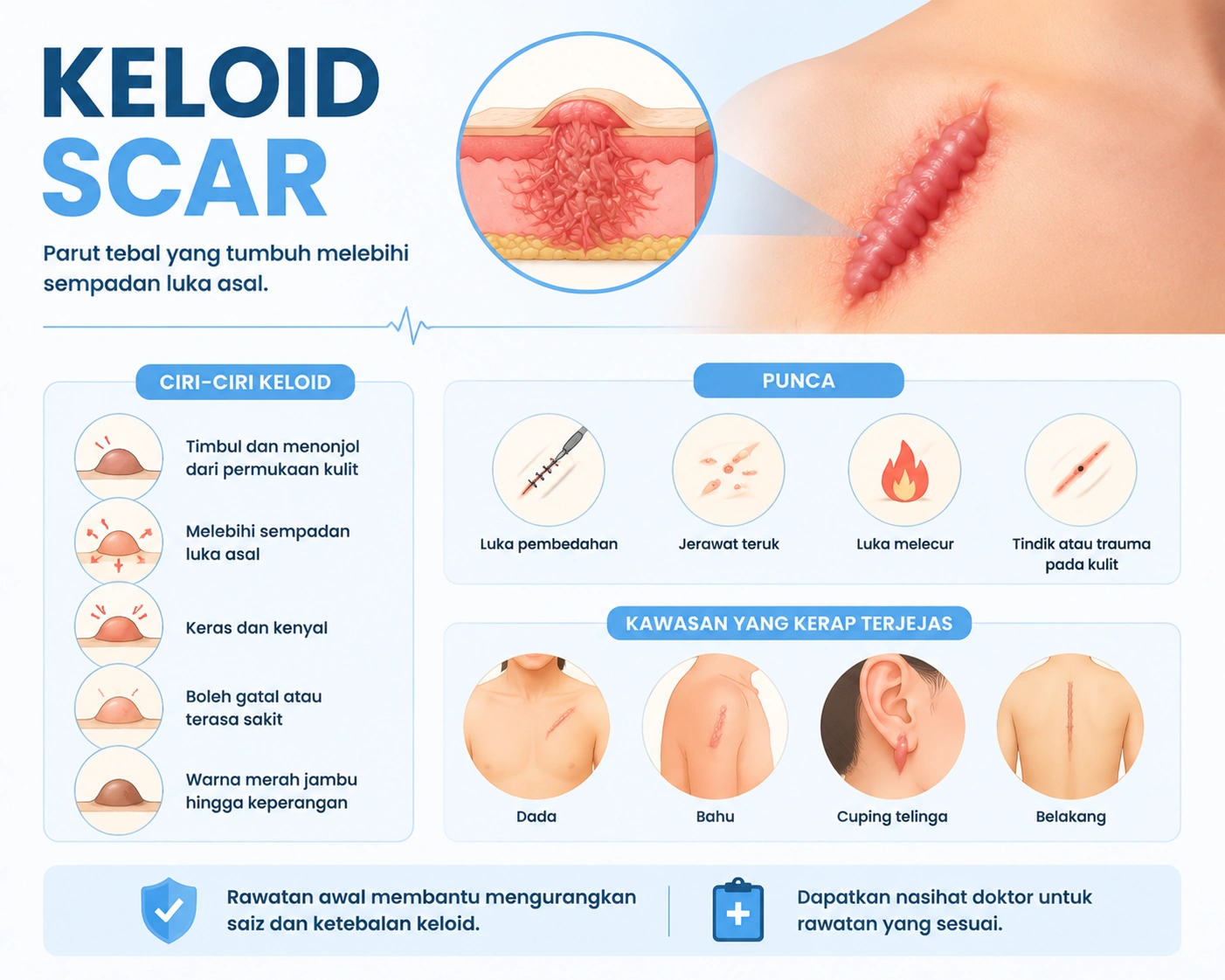 Keloid Scar: Punca, Simptom, dan Rawatan Berkesan untuk Parut Tebal