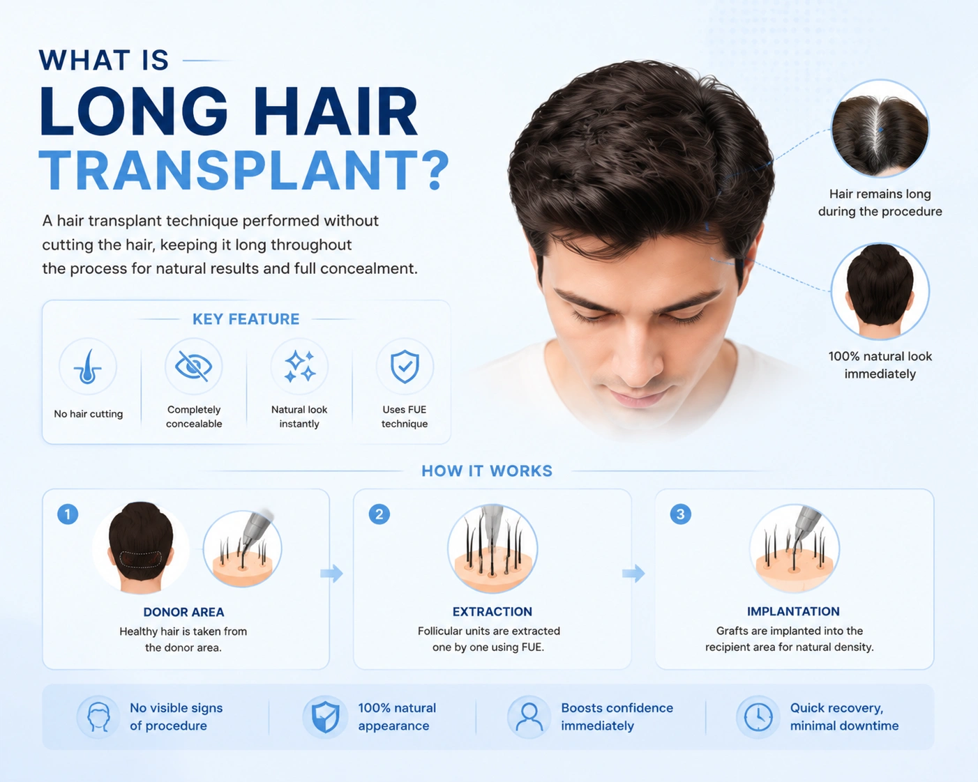long hair transplant 