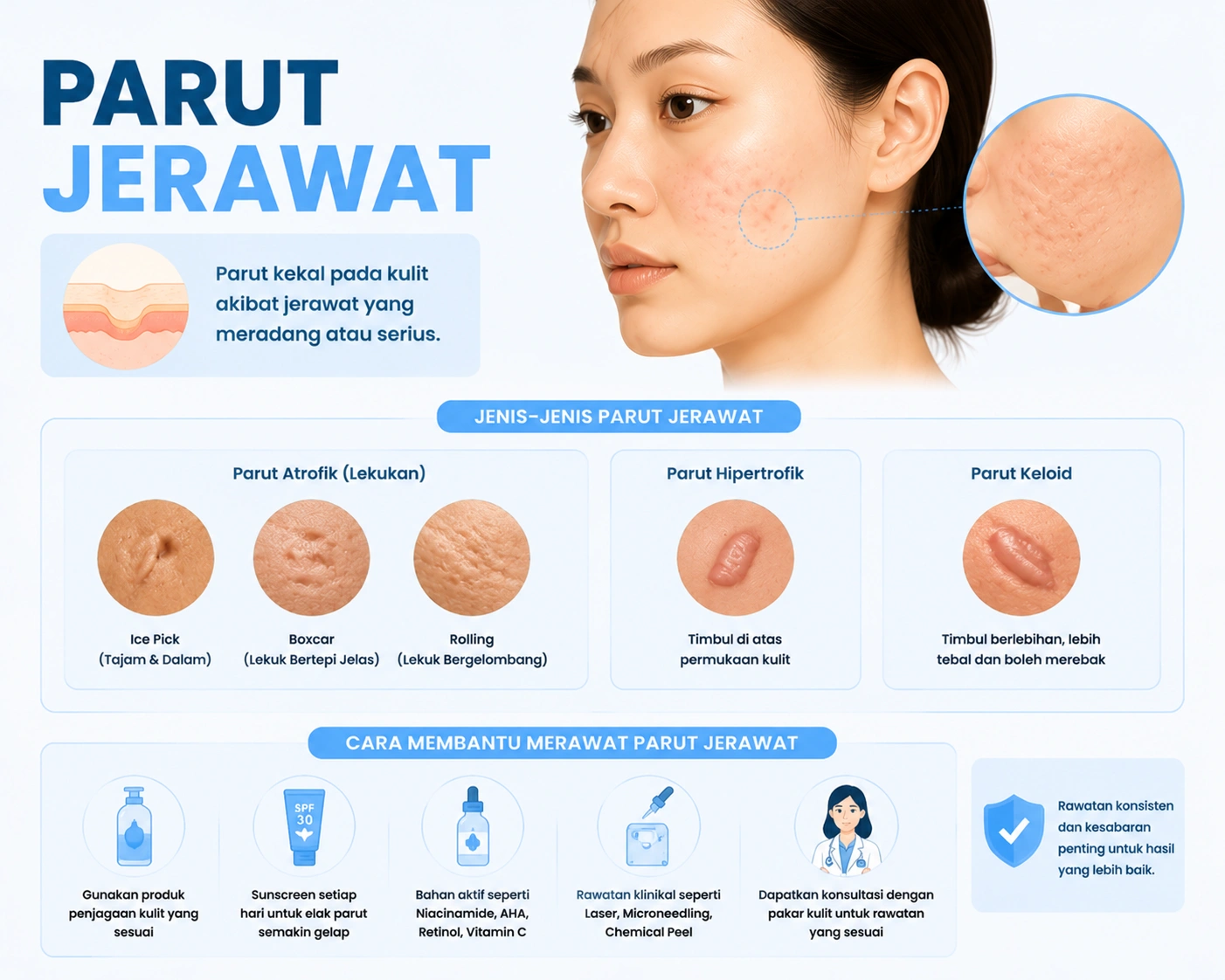 Parut Jerawat: Jenis, Punca, dan Rawatan Berkesan untuk Kulit Licin Sekata