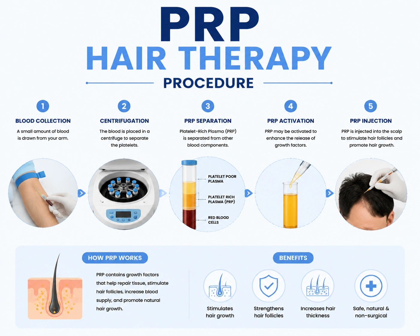 prp hair treatment cost procedure in malaysia