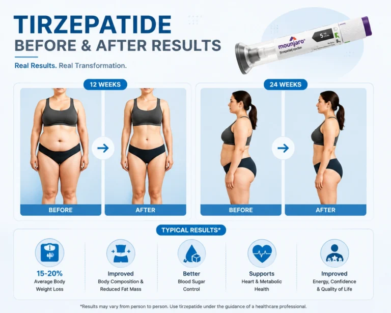 tirzepatide result mounjaro